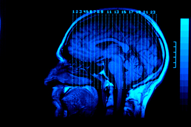 Brain
