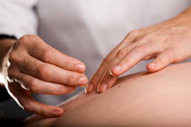 Needling
